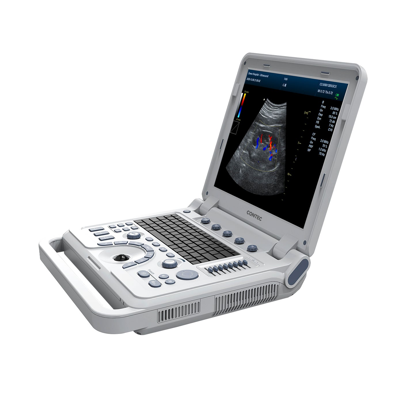 *6 REMAINING* Portable Veterinary Ultrasound Scanner: Laptop-Sized Machine with Color Doppler for Animal Pregnancy.