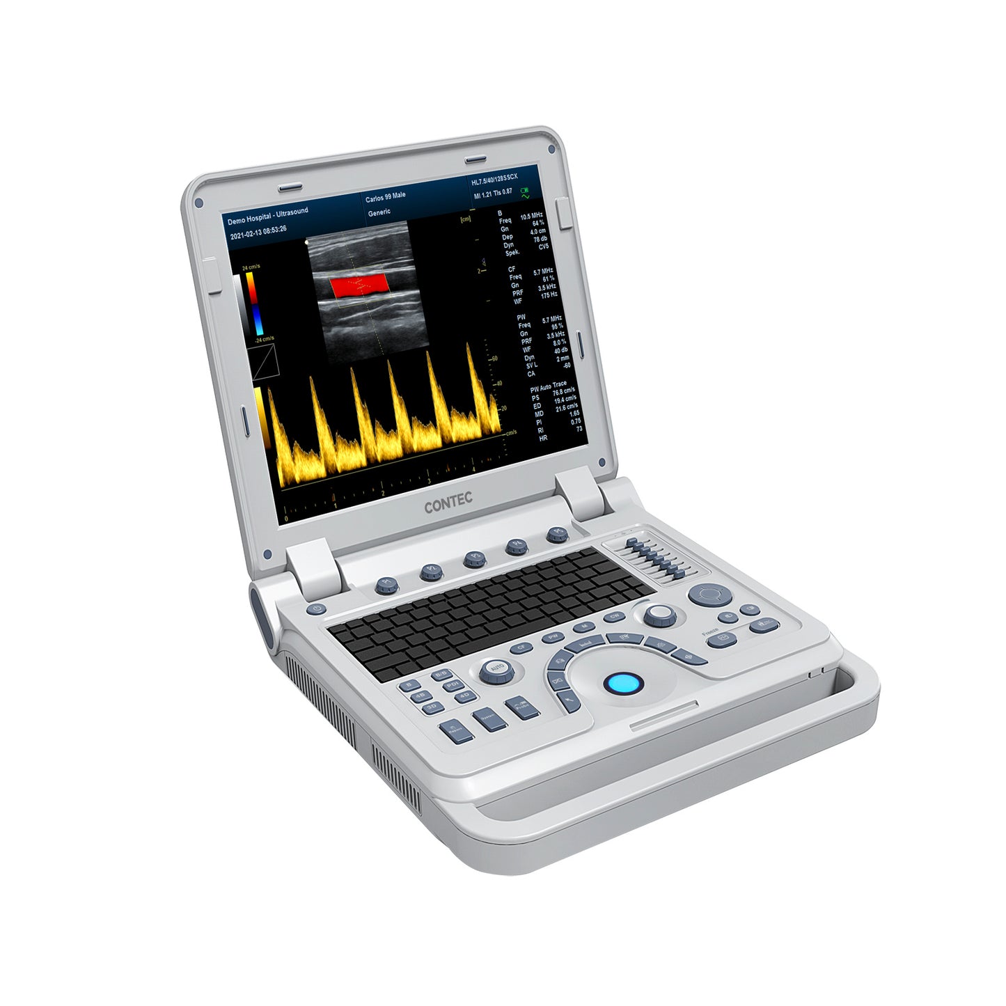 *6 REMAINING* Portable Veterinary Ultrasound Scanner: Laptop-Sized Machine with Color Doppler for Animal Pregnancy.