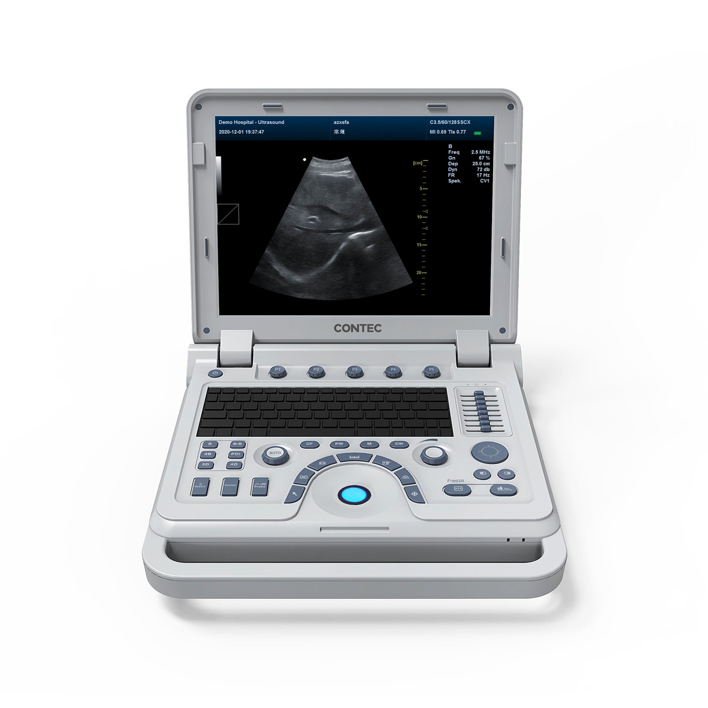 *6 REMAINING* Portable Veterinary Ultrasound Scanner: Laptop-Sized Machine with Color Doppler for Animal Pregnancy.